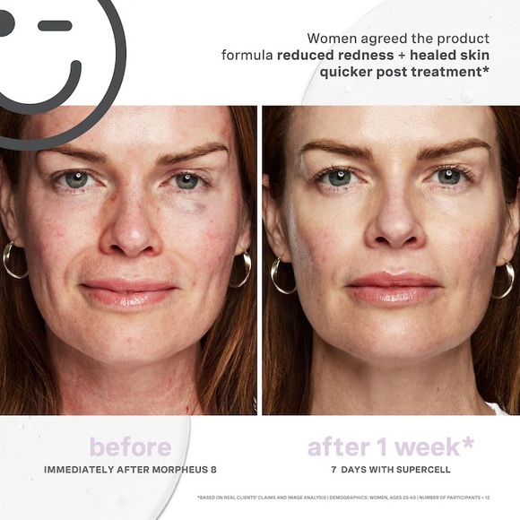 Kate Somerville KateCeuticals SuperCell Rejuvenation Peptide Serum - Picture 3 of 10